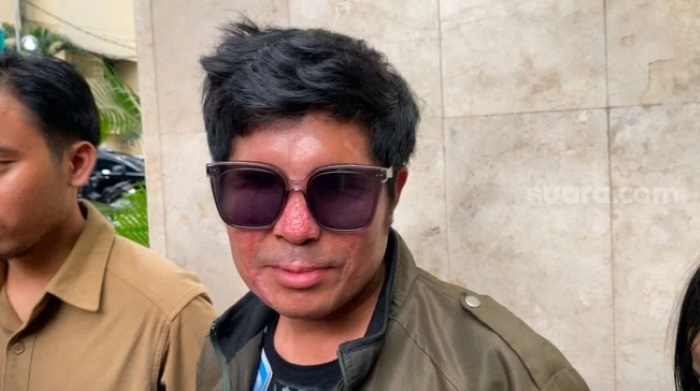 Agus Salim : Saya Akan Penjarakan Denny Sumargo, Tapi Jika Diberi Bantuan Uang Akan Saya Batalkan Laporannya