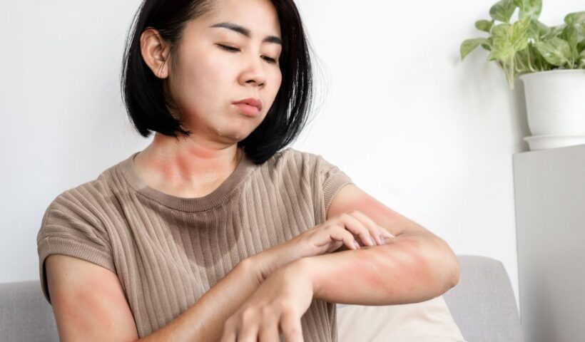 Apa Penyebab Biduran? Kenali Gejala, Pemicu, dan Cara Mengatasinya