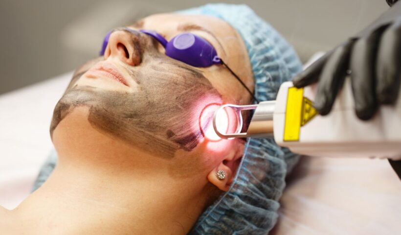 Pico Laser untuk Apa? Mengenal Fungsi, Manfaat, dan Hal yang Perlu Diketahui